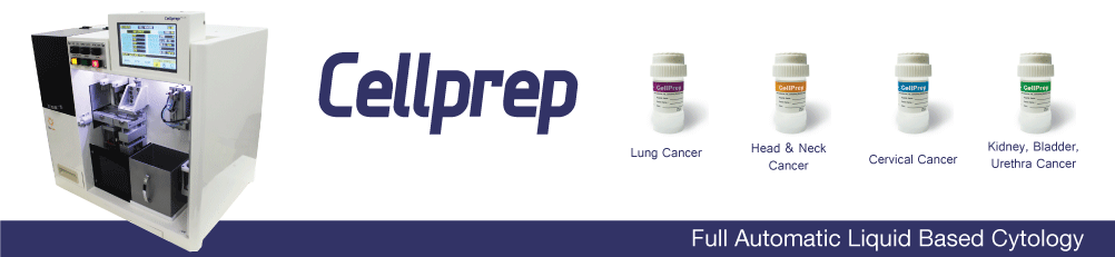 Cellprep - Liauid based cytology untuk handling sample cytology, seperti cervical cancer, lung cancer, kidney and body fluid, urine