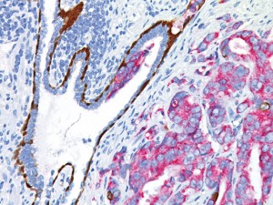 Multiple stain