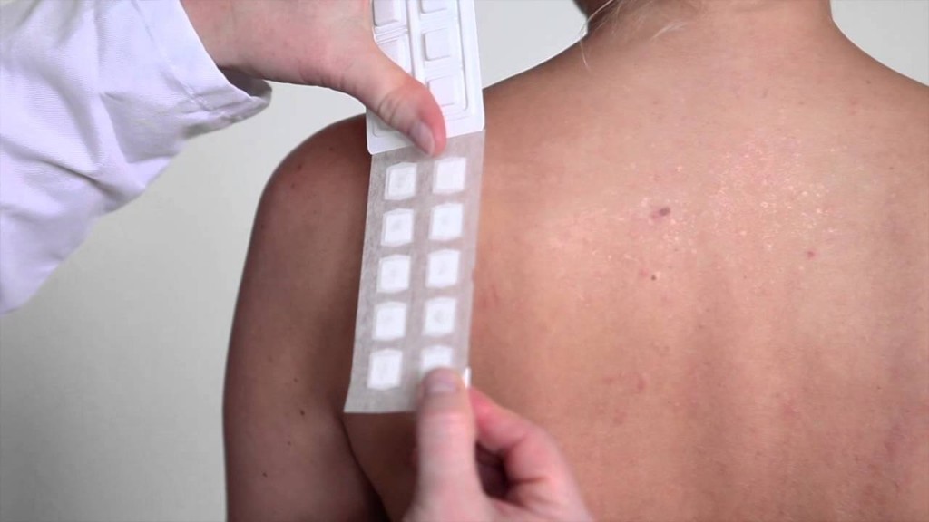 Skin Allergy patch test