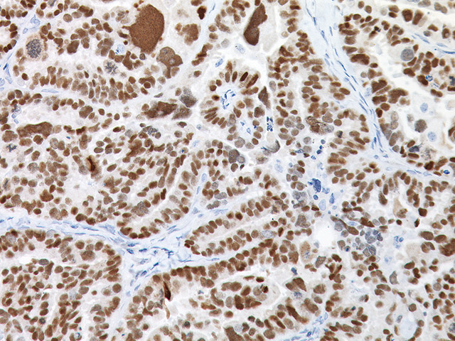 pax8 rabbit antibody