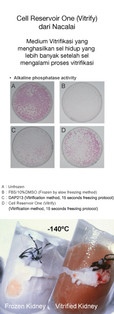 vitrification medium