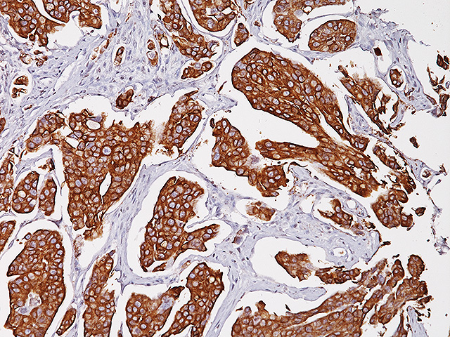 immunohistochemistry