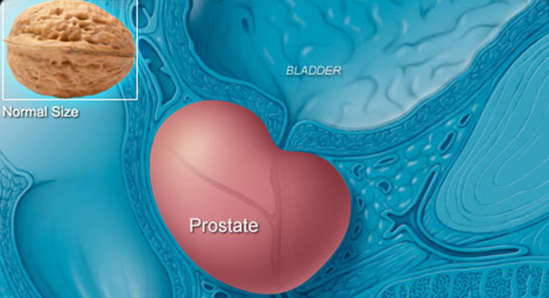 prostate