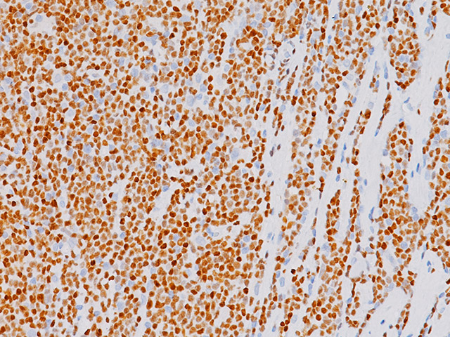 sox11 antibody