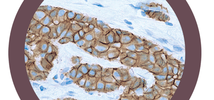 Antibody IHC – Breast focus antibody
