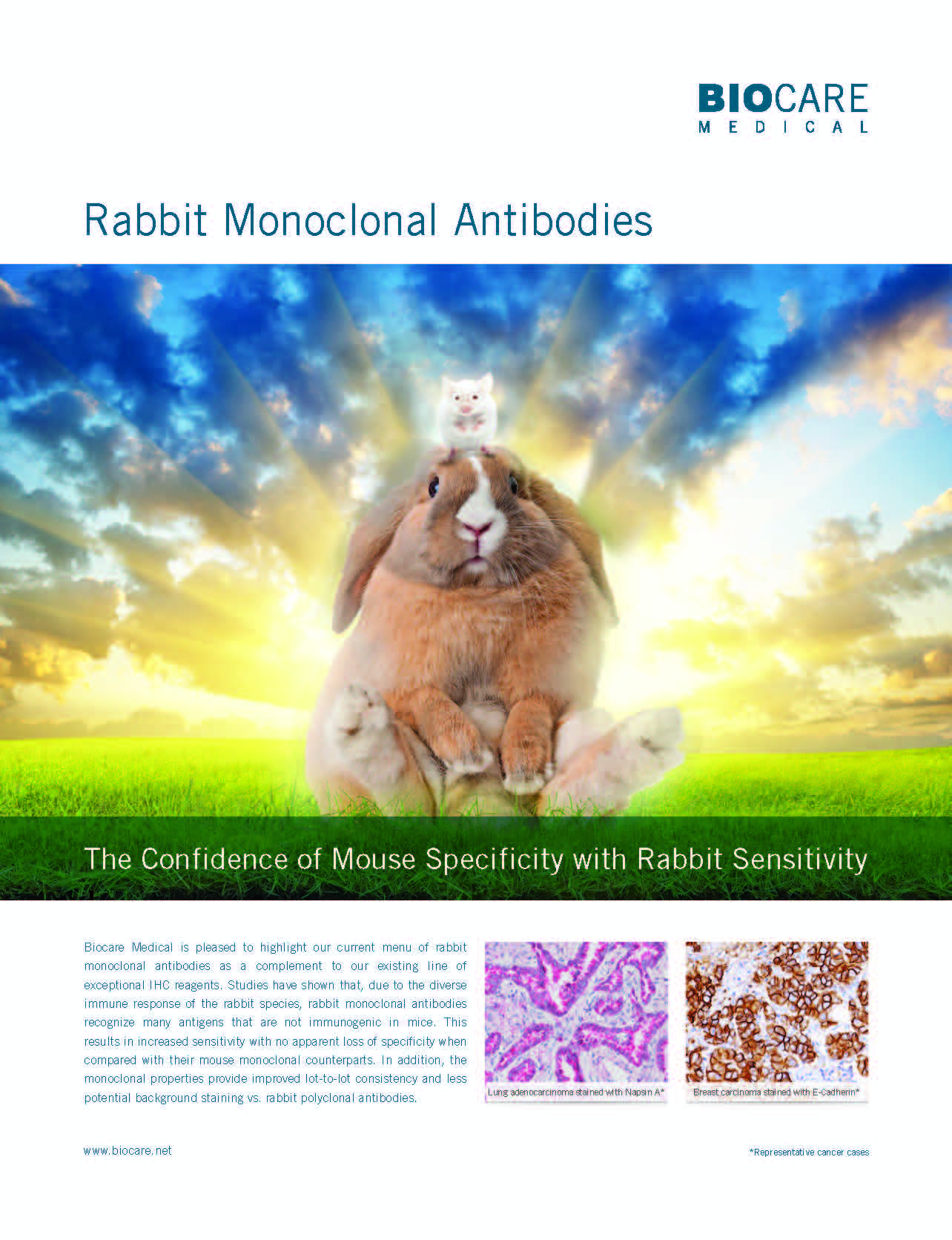 Antibody rabbit monoclonal_Page_1
