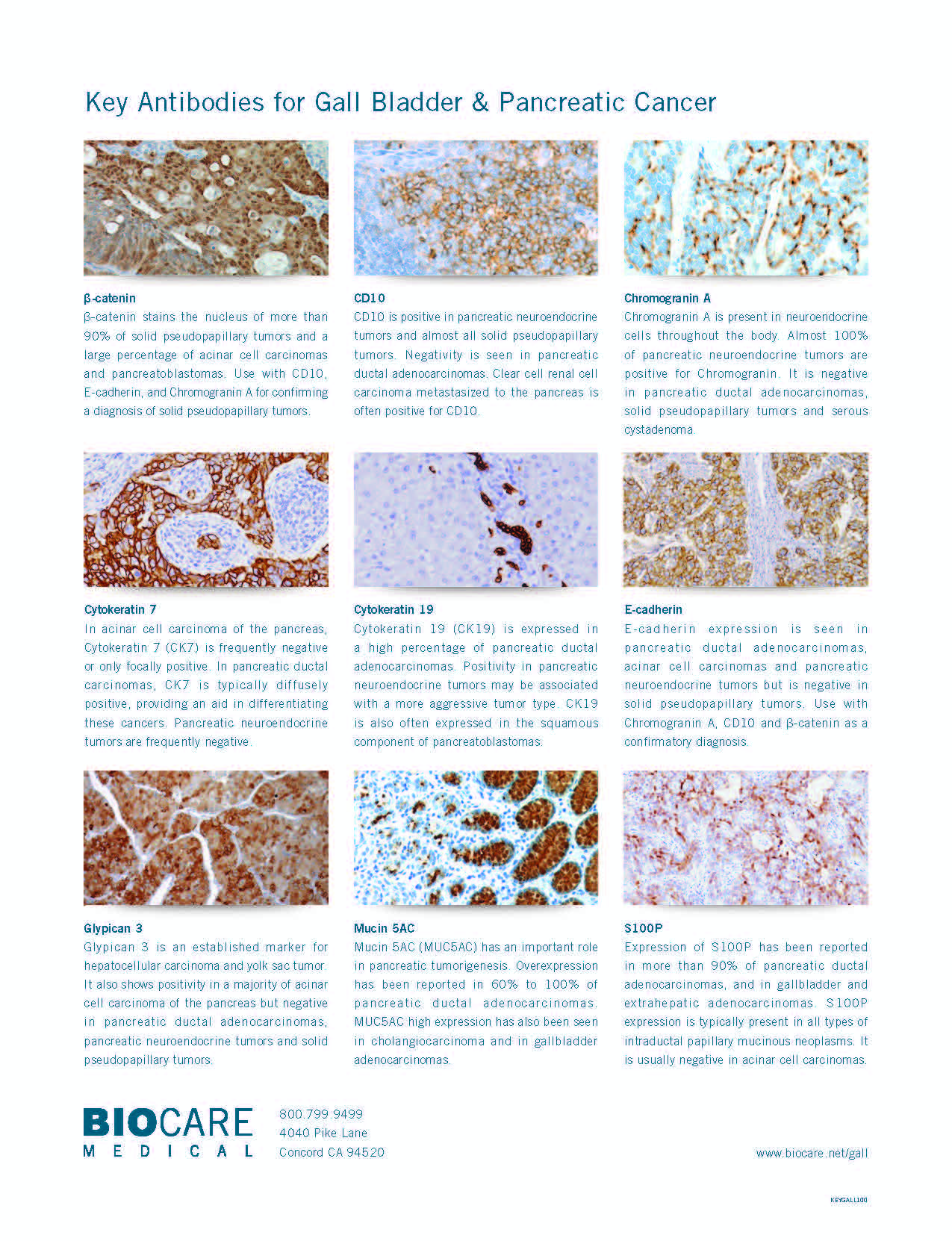 Pancrease Cancer IHC Antibody Panel_Page_2