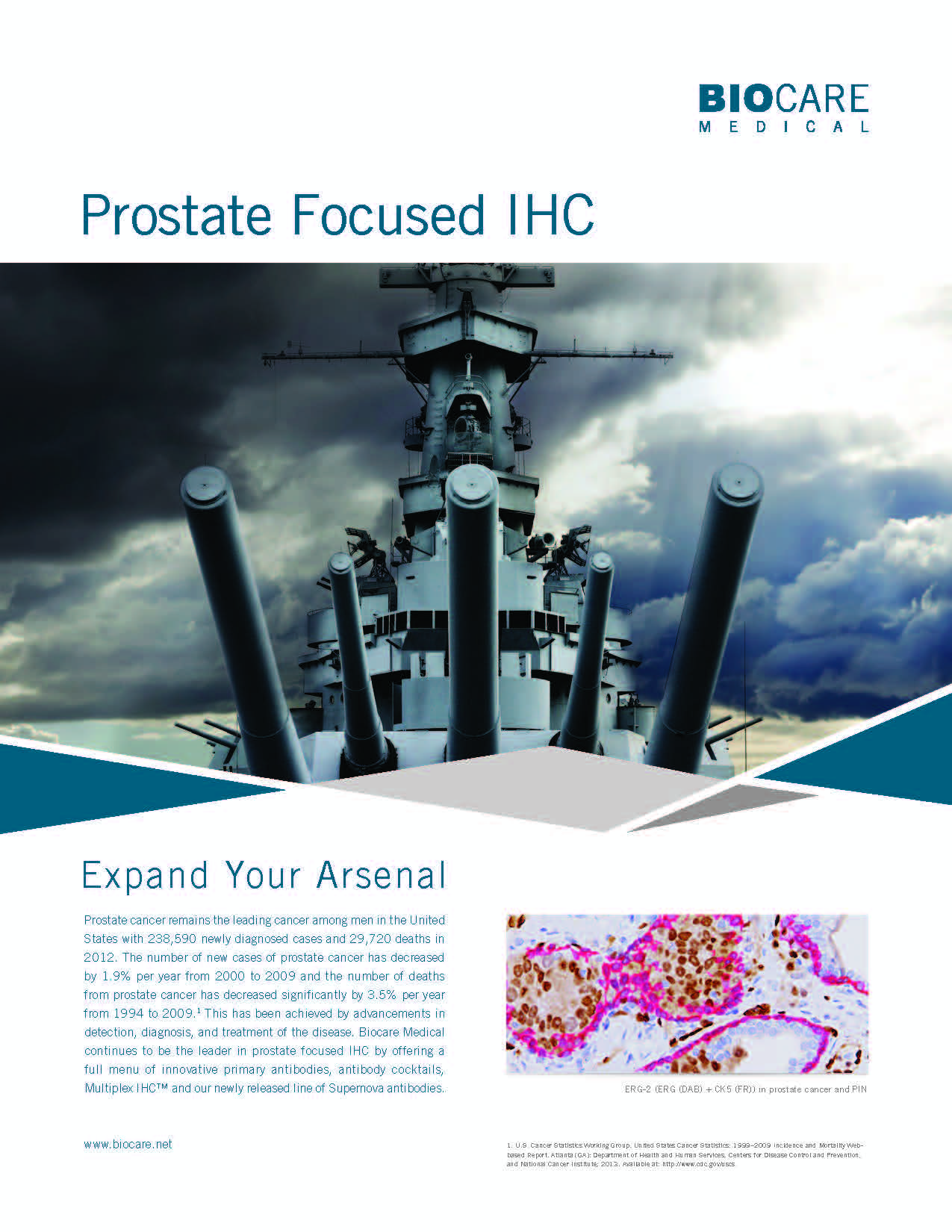 antibody Prostate cancer focus_Page_1