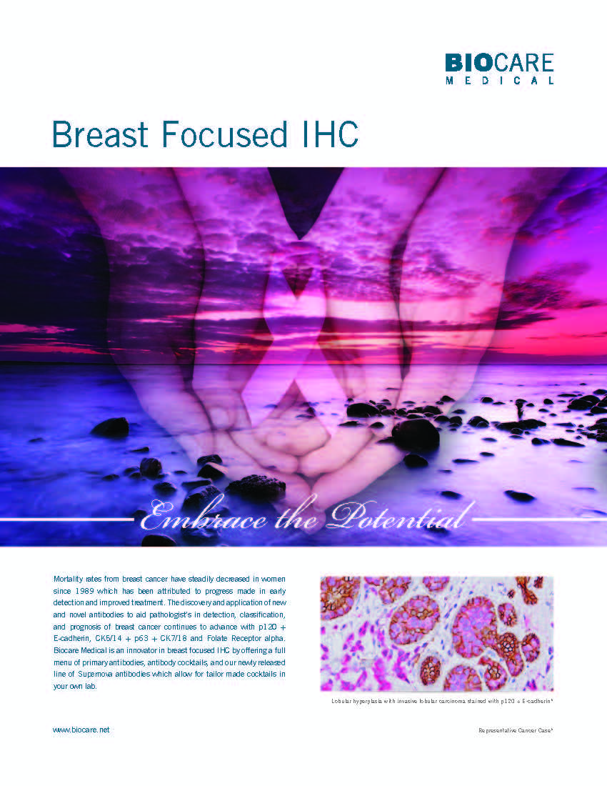 antibody breast focus antibody ihc_Page_1