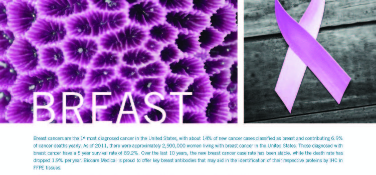 Breast Cancer Antibody Panel