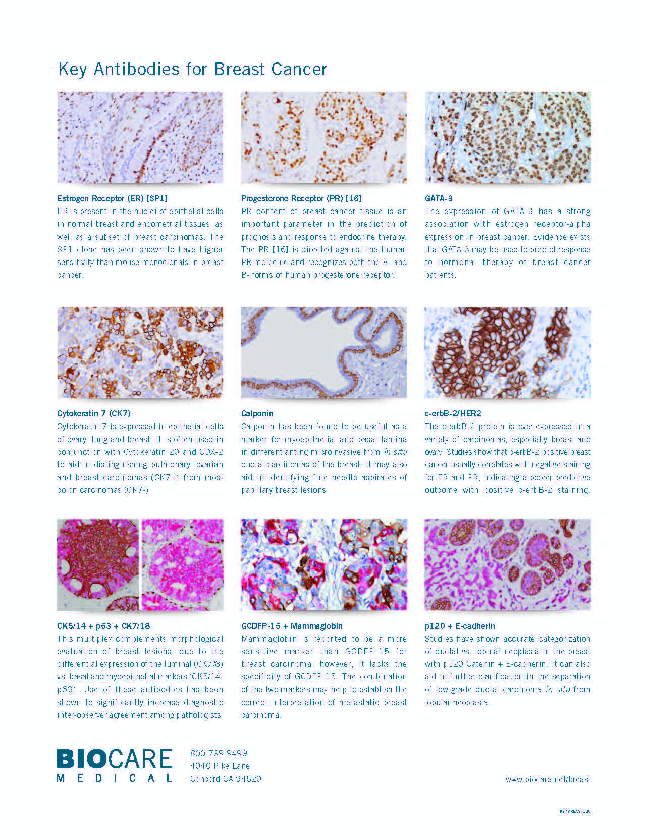 breast panel antibody_Page_2