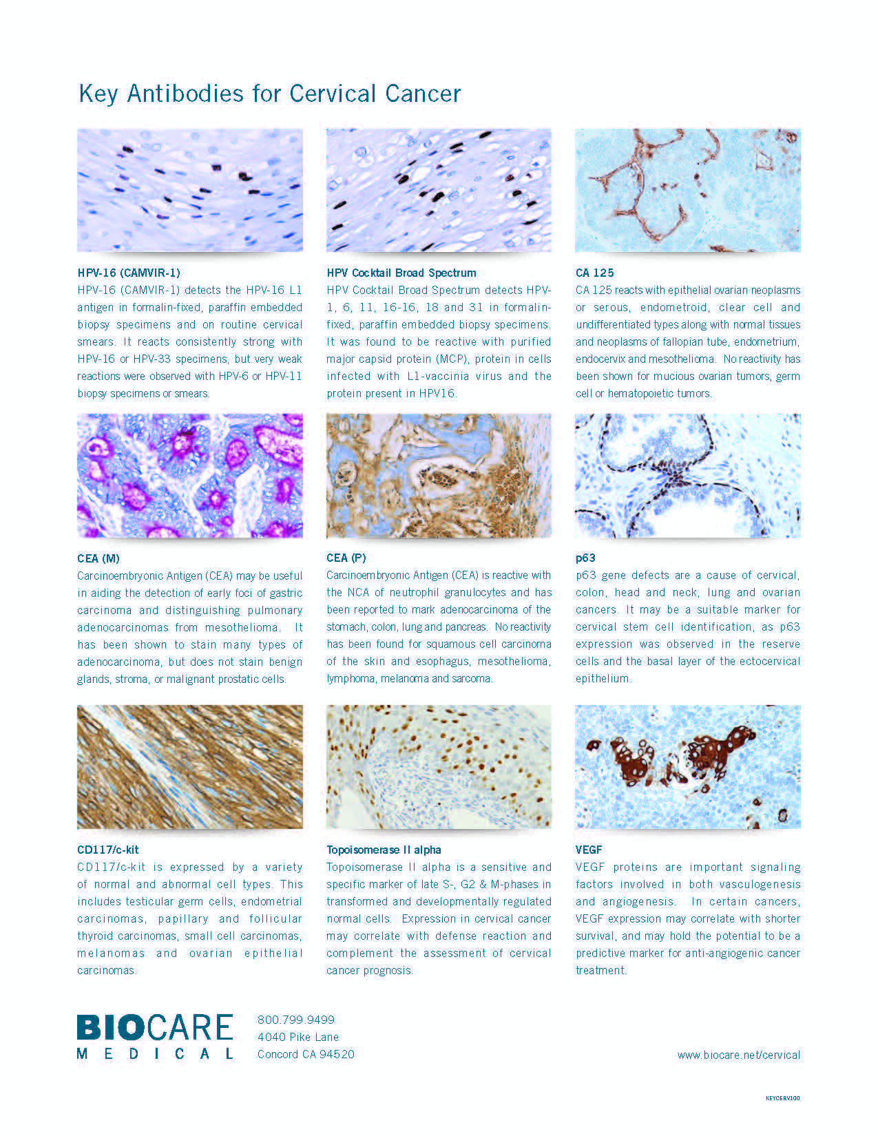 cervical cancer antibodies panel_Page_2