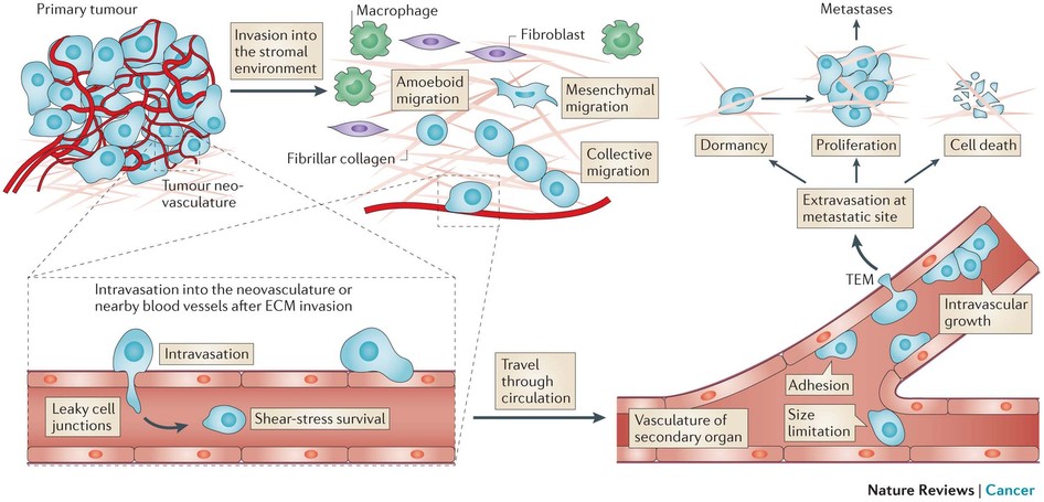 metastasis cell